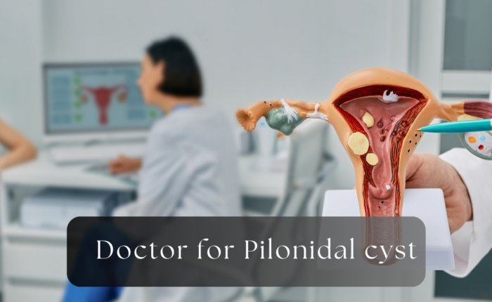 doctor for pilonidal cyst